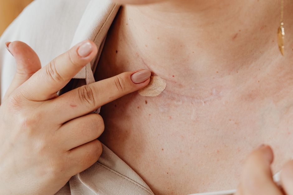 A person applies concealer on a neck scar with manicured nails in a close-up shot.